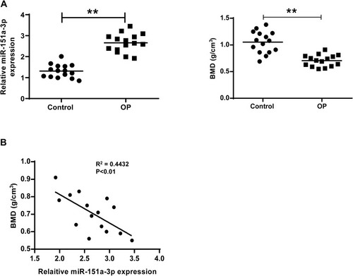 Figure 1 Patients with osteoporosis had increased microRNA-151a-3p level and reduced BMD. (A) MicroRNA-151a-3p level and BMD in patients with osteoporosis and control group were detected. (B) The correlation between microRNA-151a-3p and BMD was analyzed by Pearson’s correlation coefficient. **P < 0.01.