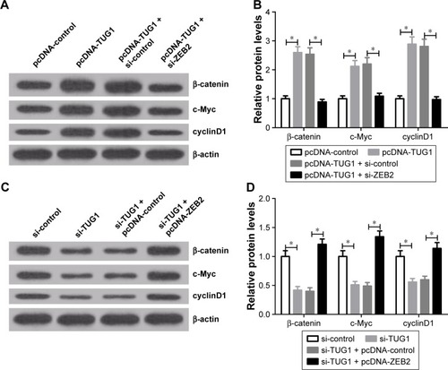 Figure 6 TUG1 regulated the Wnt/β-catenin pathway by affecting ZEB2.