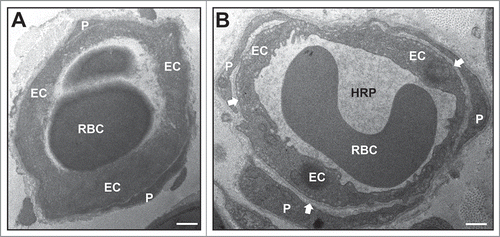 Figure 2. Early effect of crush injury on endoneurial microvascular permeability to horseradish peroxidase. Representative high magnification digital photomicrographs from the sciatic nerves of a GDNF WT mouse 2 hours following crush injury shows a horseradish peroxidase (HRP)-permeable microvessel with loss of distinct borders between endoneurial endothelial cells (EC) and pericytes (P) due to extravasation of electron-dense HRP from the lumen with a red blood cell (RBC) present (A). This is in contrast to a HRP-impermeable endoneurial microvessel from the contralateral Sham surgery control nerve with distinct borders between EC and P (white arrows) with luminal HRP and a RBC also observed. Scale bars = 500 nm.