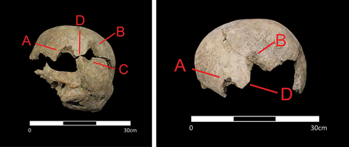 Figure 10. The parietal, temporal and occipital of Sk443 with arrows indicating each of the traumatic wounds [two photos]. Photo: K. Tait.