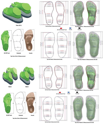 Figure 7. Area of foot measurement points: insole and outsole orthotics.