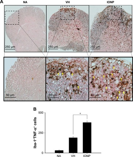 Figure 6 Treatment with ferucarbotran increased the number of Iba-1+TNF-α+ cells in the spinal cord of EAE mice.Notes: (A) Representative tissue sections double stained for Iba-1 (brown) and TNF-α (red) are shown. The lower panels are enlarged images of the dashed boxes. Arrows indicate Iba-1+TNF-α+ cells. (B) The number of double-positive cells is expressed as the mean ± standard error of 8–11 samples per group. *P<0.05 compared to the VH group. The results are representative of three independent experiments.Abbreviations: EAE, experimental autoimmune encephalomyelitis; IFN-γ, interferon-γ; IONP, iron oxide nanoparticle; NA, naïve; TNF-α, tumor necrosis factor-α; VH, vehicle.