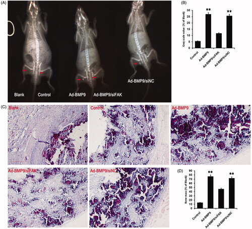 Figure 6. FAK knockdown inhibits BMP9-increased bone formation of SMSCs in vivo. (A) Cells-scaffold compound was observed via X-ray detection. (B) Statistical analysis indicated that FAK knockdown effectively suppressed BMP9-increased gray scale value. (C) Cells-scaffold compound was observed via HE staining. (D) Statistical analysis indicated that FAK knockdown markedly decreased BMP9-increased bone mass. **p < .01, as compared with Ad-BMP9/siFAK.