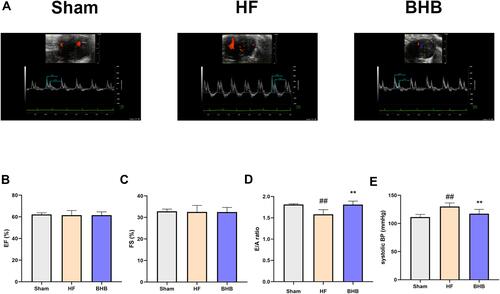Figure 1 BHB improved cardiac diastolic dysfunction in HFpEF mice. C57B/6 male mice were divided into three groups: Sham, HF, and BHB group. (A) Representative echocardiographic images between groups. (B) Left ventricular ejection fraction (EF, %). (C) Left ventricular fraction shortening (FS, %). (D) E/A ratio. (E) systolic blood pressure (systolic BP, mmHg). n = 5 mice/group. ##p < 0.01 vs sham; **p<0.01 vs HF.