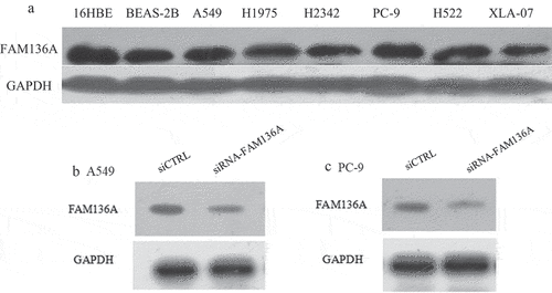 Figure 3. Expression and knockdown of FAM136A expression in NSCLC cell lines. (a) The expression of FAM136A in 7 NSCLC cell lines was detected by Western blotting. (b) and (c).Western blotting analysis of FAM136A expression in A549 and PC-9 cells transfected with FAM136A siRNA. FAM136A siRNA markedly reduced the FAM136A protein level in A549 and PC-9 cells. GAPDH was used as an internal control. 16HBE: Human bronchial epithelial, BEAS-2B: immortalized human bronchial epithelial cells, A549, H1975, H2342, PC-9, H522, XLA-07: human lung adenocarcinoma cell