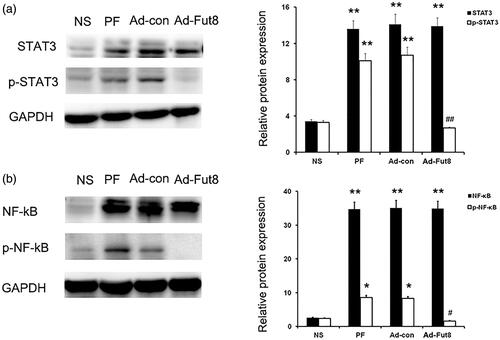 Figure 5. Fut8shRNA abolished activation of EGF signaling pathway. Representative western blot images and analyses of STAT3/p and STAT3, and NF -κB/p and NF-κB. *p < 0.05, **p < 0.01 vs. NS group. #p < 0.05, ##p < 0.01 each group (except for NS group) vs. both PF and Ad-con group.