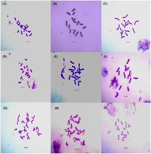 Figure 2. Giemsa and orcein stained well-scattered somatic metaphase plates in different cultivars of L. culinaris: (A) L. culinaris (EC 78498); (B) L. culinaris (EC267877); (C) L. culinaris (micro, Bankura); (D) L. culinaris (macro, Barasat); (E) L. culinaris (micro, Barasat); (F) monosomic metaphase plate of L. culinaris (EC, 78410) showing 2n = 13 chromosomes; (G) monosomic metaphase plate of L. culinaris (IPL81) showing 2n = 26 almost separated chromatids; (H) L. culinaris ((IPL316) metaphase plate showing 2n = 28 almost separated chromatids; (I) orcein stained somatic metaphase plate with 2n = 14 chromosomes in L. culinaris (macro Barasat). Scale bars: 5 μm.