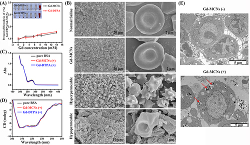 Figure 2 (A) Hemolysis rates of red blood cells in Gd-MCNs and Gd-DTPA solutions with different concentration and the corresponding picture (insert); (B) SEM images of red blood cells incubated with normal saline, Gd-MCNs, 0.45% NaCl (hyperpermeable) and 1.35% NaCl (hypopermeable); UV-vis absorbance spectra (C) and circular dichroism (D) of BSA, BSA + Gd-MCNs and BSA + Gd-DTPA; (E) TEM images of macrophage phagocytosis before and after incubation with Gd-MCNs. The red arrows indicate the internalized Gd-MCNs.