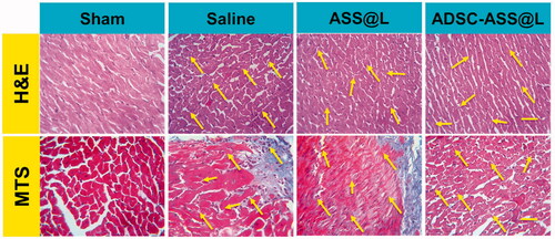 Figure 7. Regressions of myocardial fibrosis and cardiac hypertrophy in experiments. (A) Illustrative images of H&E staining and Masson staining (MTS) images of left ventricular tissue sections (magnification = 200×).