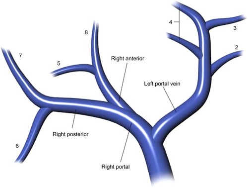 Figure 1 Diagram of the portal venous anatomy to the liver.