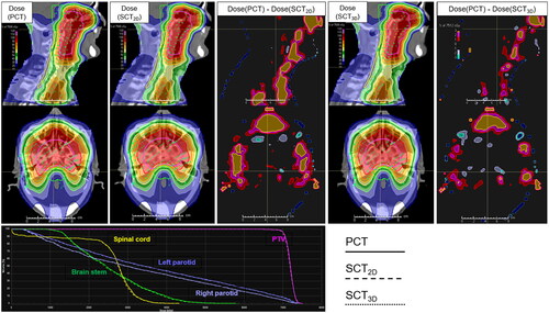 Figure 5. The dose distributions calculated on the PCT image and the SCTs, the dose discrepancies, and the corresponding DVH for a test patient with an average dosimetric performance.