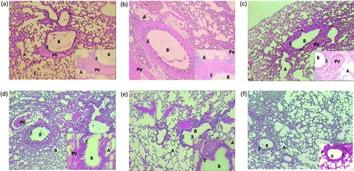 Figure 5. Histological alteration in lung tissue of mice: photomicrograph of lung sections stained with hematoxylin and eosin: (a) the normal group shows alveoli and bronchioles having normal architecture. Epithelial cells linings are intact and inflammation is absent. (b) The AR control group section shows abnormal bronchiole epithelium and degenerated alveolar sacs. (c) Montelukast (10 mg/kg) treated group section shows partial cell disruption in alveoli and bronchioles. The epithelial cell linings show less damage. (d) The PIP (10 mg/kg) treated group demonstrates intact epithelial cell linings; partial protection of bronchioles and alveoli, with minimum Inflammation. (e) The PIP (20 mg/kg) treated group shows moderate intact alveoli and bronchiolar structures. (f) The PIP (40 mg/kg) treated group sections showed more protective effect on alveoli and bronchiolar epithelial membrane. A, alveoli; E, epithelium; B, bronchiole; PV, pulmonary vein; PIP, piperine; Monte, montelukast. Figure in parentheses indicates dose in mg/kg, p.o. (40 × ).