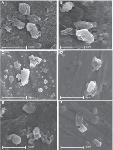 Figure 1 Scanning electron micrographs of recrystallized MBZ, RDM-1:5 and RDM-0:5, suspended in carbon tetrachloride (A, C, and E) and recrystallized MBZ, RDM-1:5 and RDM-0:5, suspended in distilled water (B, D, and F) at ×3,000 magnifications.