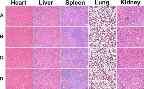 Figure 5 Representative images of H&E staining of heart, liver, spleen, lung, and kidney sections in the group of (a) NS, (b) Blank Gel, (c) Free NCTD/Dox, and (d) NCTD-NPs/Dox Gel (× 200).