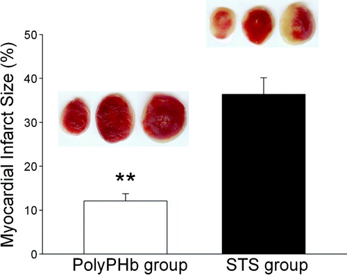 Figure 4.  Myocardial infarct size determined by TTC staining. Red staining areas indicate viable tissue and non-stained pale areas indicate infarct tissue. Representative TTC-stained myocardial sections were shown at the top. Values were presented as mean±SEM (n = 5, 5 to 6 slices per heart). **P < 0.01 vs STS group.