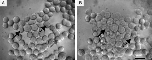 Figure 3. Neural cells suspended in the ultrasound trap: (a) 1 min, and (b) 30 min after initiation of ultrasound. Membrane spreading (grey arrow), blebbing (black arrow) and loss of refractility (dotted arrow) are shown. Scale bar is 25 µm.