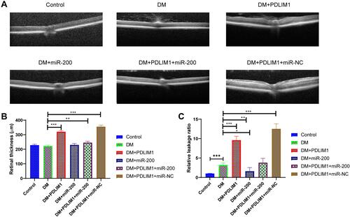 Figure 2 Effects of miR-200a, PDLIM1 and diabetic status on retinal thickness and leakage. (A) Optical coherence tomography (OCT) images of retinas for different groups, including normal, DM, DM+PDLIM1, DM+miR-200a, DM+PDLIM1+miR-200a, DM+PDLIM1+miR-NC; (B) retinal thickness based on OCT in normal, DM, DM+PDLIM1, DM+miR-200a, DM+PDLIM1+miR-200a, DM+PDLIM1+miR-NC groups; (C) retinal leakage based on Evans Blue assay in normal, DM, DM+PDLIM1, DM+miR-200a, DM+PDLIM1+miR-200a, DM+PDLIM1+miR-NC group. Data are expressed as mean ± SD. *P<0.05, **P<0.01, ***P<0.001.