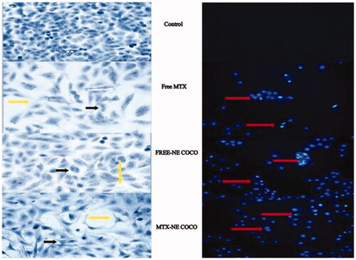 Figure 3. (A) Light microscopy images of A549 non-small cell lung cancer cells treated for 24 h at the IC50 of free MTX, free-NE COCO, and MTX-NE COCO. Signs of apoptosis are represented by the black arrows (chromatin condensation) and yellow arrows (intercellular space). Images were magnified at ×40. (B) Fluorescence microscopy images of DAPI stained A549 non-small cell lung cancer cells treated for 24 h at the IC50 of free MTX, free-NE COCO, and MTX-NE COCO. The red arrows point at the altered nuclei (chromatin condensation). Images were magnified at ×20.