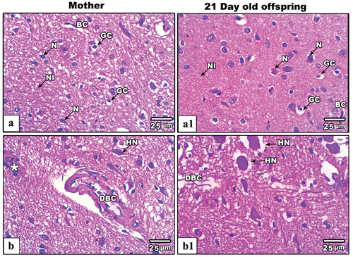 Figure 5. Images from histological sections of cerebral cortex of control and IS mother’s rats (panels a&b) and their offspring at PND21 (b&b1) respectively. The cerebral cortex of IS mothers rats and their offspring display obvious hypertrophied neurons (HN), dilated blood capillaries and infiltrated cells (star). (H&E stain, scale bar: 25µm). Abbreviations: Glial cells (GC), Pyramidal neurons (N) and Interstitial neuropils (NI), Blood capillaries (BC), Hypertrophied neurons (HN), Dilated blood capillaries (DBC), and Infiltrated neurons (asterisk).