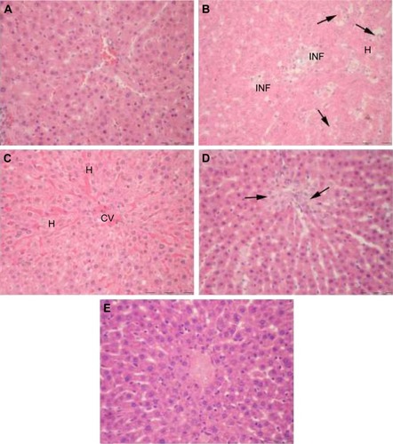 Figure 4 Microphotographs of H and E-stained liver sections of rats. (A) Control depicts normal liver parenchyma. (B) Arsenic: note degeneration of hepatocytes (arrows), vascular congestion/hemorrhage (H), and multiple inflammatory sites (INF). (C) Arsenic + NAC: hepatocytes are intact but congestion and widening of sinusoidal spaces are still found. (D) Arsenic + DMSA: foci of parenchymal degeneration and necrosis are obvious (arrows). (E) Arsenic + NAC + DMSA: liver architecture is comparable to control without inflammatory characteristics. Original magnification 400× (A–E).