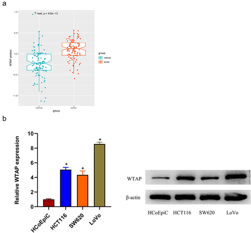 Figure 1. WTAP is highly expressed in colon cancer tissues and cells. a: The expression of WTAP protein in colon cancer tissues; b: The expression of WTAP in colon cancer cell lines (HCT116, SW620, and LoVo) and human normal colon epithelial cells (HCoEpiC) was detected by qRT-PCR and western blot; * indicates P < 0.05.
