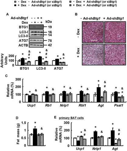 Figure 5. BTG1 knockdown blocks Dex-induced BAT whitening in vivo and in vitro. (A-D) Protein levels of BTG1, ATG7 and LC3-II in BAT (A), BAT H&E staining (B), mRNA levels of brown adipocyte markers and white adipocyte markers in BAT (C), and body fat mass component (D) were analyzed in male WT mice infected with Ad-shBtg1 (+ Ad-shBtg1) or Ad-Scrambled (- Ad-shBtg1) for 3 days, followed by i.p. injection of Dex (+ Dex) or PBS (- Dex) for 1 week. (E) mRNA levels of brown adipocyte markers and white adipocyte markers were analyzed in primary cultured brown adipocytes transfected with (+ siBtg1) or without (- siBtg1) Btg1 siRNA for 48 h, prior to being treated with Dex (+ Dex) or PBS (- Dex) for 24 h. Scale bars: 200 μm in B. Data are represented as mean ± SEM. Statistical significance was calculated using one-way ANOVA followed by the Student-Newman-Keuls (SNK) test for the effects of any group versus the control group (*: p < 0.05), with versus without Dex in BTG1 knockdown group (#: p < 0.05), with versus without BTG1 knockdown in Dex group (&: p < 0.05) in A and C-E.