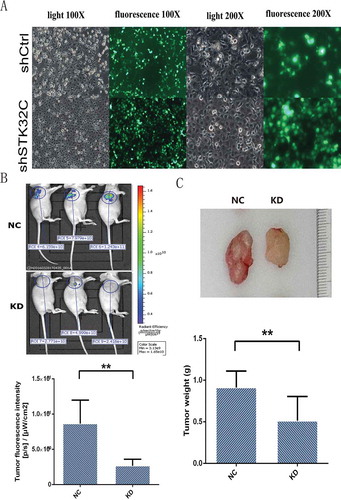 Figure 5. In vivo animal experiments. (a) T24 cells used for animal tumor formation experiments were observed by fluorescence microscopy, and most of the injected cells (> 90%) were transfected effectively. (b) The fluorescence imaging was observed from the live mice. The results found that tumor fluorescence intensity was decreased significantly in the KD groups. (c) After 28 days, tumors were harvested and mice were euthanized, tumor weights in the KD groups were heavier than the controls. (P < 0.001).