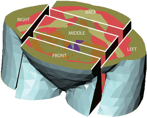 Figure 1. Partitioning of the transversal slice located at the target region into a front, middle, back, left, and right part. The central region is constrained by the smallest box containing the vagina, tumor, and uterus.