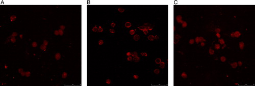 Figure 4. Localization of the NF-κB p65 subunit in KM3 cells as assessed by laser confocal fluorescence microscopy. (A) KM3 group. (B) KM3/hUCBDSC co-culture group. (C) KM3/MM-BMSC co-culture group After sub-culture for 4 days, KM3 cells from each of the three groups were collected, and the localization of the NF-κB p65 subunit in KM3 cells was examined by laser confocal fluorescence microscopy. In KM3 cells co-cultured with MM-BMSCs the NF-κB p65 subunit was almost exclusively localized to the nucleus, whereas the NF-κB p65 subunit was localized to the nucleus in only some KM3 cells when co-cultured with hUCBDSCs. Each experiment was performed three times. hUCBDSCs, human umbilical cord blood-derived stromal cells; MM-BMSCs, multiple myeloma bone marrow stromal cells; NF-κB, nuclear factor κB.