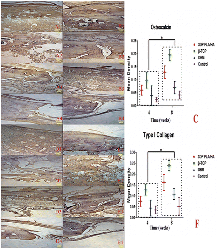 Figure 8. Immunohistochemical examination of osteocalcin and type I collagen were carried out in the margin of bone defect in different time (magnification ×100). (A) Osteocalcin expression images of implanted (1) PLA/HA, (2) β-TCP and (3) DBM scaffolds as well as (4) control group four weeks after implanting. (B) Osteocalcin expression images of implanted (1) PLA/HA, (2) β-TCP and (3) DBM scaffolds as well as (4) control group eight weeks after implanting. (C) Semi-quantitative scatter plot of osteocalcin expression. (D) Type I collagen expression images of implanted (1) PLA/HA, (2) β-TCP and (3) DBM scaffolds as well as (4) control group four weeks after implanting. (E) Type I collagen expression images of implanted (1) PLA/HA, (2) β-TCP and (3) DBM scaffolds as well as (4) control group eight weeks after implanting. (F) Semi-quantitative scatter plot of type I collagen expression (*p＜0.05).