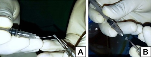 Figure 3 Method of loading the “stopper” to the 27-gauge needle which prevents the haptic from slipping back into the vitreous cavity after externalization.