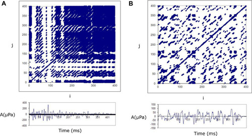 Figure 2 TypicalCitation32 recurrence plots (top panel) and the corresponding TEOAE responses (bottom panel) from a normal and an ARHL case.