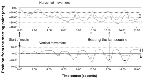 Figure 1 Motion analysis of an 11-year-old patient.