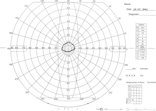 Figure 8 Manual perimetry in OD.