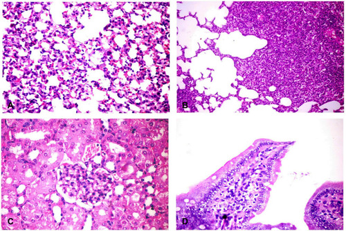 Figure 3 Histopathological changes in different organs of challenged mice. (A) Lung showing thickening of the alveolar wall by dilated perialveolar blood capillaries, inflammatory cells mainly neutrophils and mononuclear cells (H&E X400). (B) Lung showing severe fibrinopurulent pneumonia with giant alveoli (H&E X400). (C) Kidney showing glomerular hypertrophy with mesangial hypercellularity (H&E X400). (D) Intestine showing sloughing and desquamation of individual enterocytes with increased lamina propria macrophages, lymphocytes and neutrophils (H&E X200). H&E, hematoxylin and eosin stain.