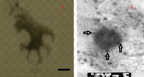 Figure 3.  Transmission electron microscopic pictures of pegylated nanoparticles.
