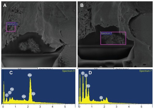 Figure 11 Cell viability dual-beam (FIB/SEM) images of SH-SY5Y cells incubated with 5 μg/mL PLL-MNPs for 24 hours. (C and D) are the EDX spectra from the corresponding areas of the (A and B) (pink squares), confirming the presence of MNPs in the cell membrane (A and C) and the intracellular space (B and D).Abbreviations: FIB, focused ion beam; MNPs, magnetic nanoparticles; PLL-MNPs, poly-l-lysine-magnetic nanoparticles; SEM, scanning electron microscopy.