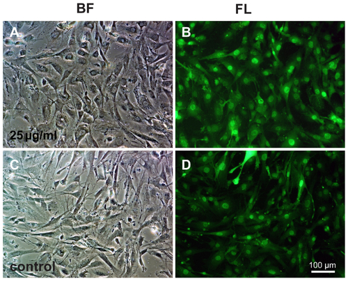 Figure S1 Morphology of GFP-ADSCs labeled with 25μg/mL SPIO.Notes: (A) Bright field of cells labeled with 25μg/mL SPIO. (B) Fluorescent microscopy image of the same view of A showed GFP expression of whole labeled cells. (C) Negative control cells without treatment with SPIO. (D) The same view of C was observed under fluorescence microscopy. Scale bar measures 100 μm.Abbreviations: GFP-ADSCs, green fluorescent protein-adipose-derived stem cells; BF, bright field; FL, fluorescent light.