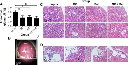 Figure 6 Renal pathological changes in lupus mice undergoing different treatments (magnification: 10×, H&E stained).