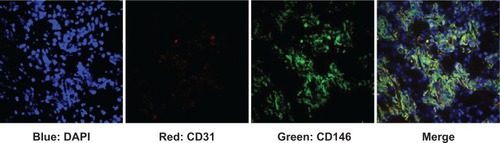 Figure 10 Immunofluorescence staining of MKN45 tumor tissue.Notes: CD146/CD31 staining of xenograft tumor tissues revealed that CD146 was highly expressed on the MKN45 tumor (40× oil). Green: CD146; red: CD31; blue: DAPI.Abbreviation: DAPI, 4′,6-diamidino-2-phenylindole.