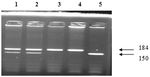 Figure 2. Genotyping of vascular endothelial growth factor (VEGF) gene G-1154A polymorphisms. Lane 1 and 2: G/A genotype (184, 150, 34, 22, and 86 bp), Lane 3 and 4: A/A genotype (184 and 22 bp), Lane 5: G/G genotype (150, 34, and 22 bp).