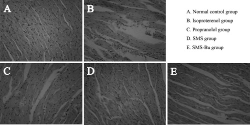 Figure 2. Effects of SMS and SMS-Bu on histopathological changes. (A–E) Representative light microscopic appearance of mice myocardial histopathological morphology (hematoxylin staining; original magnification ×200) for control group (A), ISO group (B), propranolol group (C), SMS group (D), SMS-Bu group (E). Abbreviations: ISO, isoproterenol; SMS, Sheng-Mai-San; SMS-Bu, n-butanol extraction of SMS.