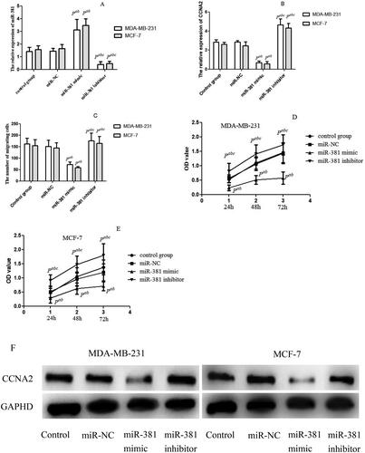 Figure 3. miR-381 could inhibit breast cancer cells proliferation and migration. (A) MCF-7 and MDA-MB-231transfected with miR-381 mimic or miR-381 inhibitor both had significantly increased or decreased miR-381 expression (detected by qRT-PCR) compared with miR-NC and control groups; (B) MCF-7 and MDA-MB-231transfected with miR-381 mimic or miR-381 inhibitor both had significantly decreased or increased CCNA2 expression (detected by qRT-PCR) compared with miR-NC and control groups; (C) MCF-7 and MDA-MB-231 transfected with miR-381 mimics or miR-381 inhibitors both had significantly decreased or increased migrating cells compared with miR-NC and control groups; (D and E) MCF-7 and MDA-MB-231transfected with miR-381 mimics or miR-381 inhibitors both had significantly decreased or increased proliferation rate compared with miR-NC and control groups; (F) MCF-7 and MDA-MB-231 transfected with miR-381 mimics had obviously decreased the expression of CCNA2, while the cells transfected with miR-381 inhibitor had obviously increased the expression of CCNA2 (detected by Western blot). GAPHD: a reference gene. qRT-PCR: quantitative real-time polymerase chain reaction. MDA-MB-231 and MCF-7: human cancer cell lines. MCF-10A: human breast epithelial cell. CCNA2: Cyclin A2. Compared with control group, Pa < 0.05; Compared with miRNA-NC group, Pb < 0.05; Compared with miR-381 mimic group, Pc < 0.05.