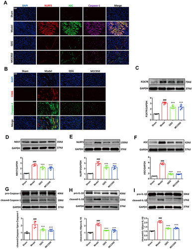 Figure 3 QSG inhibited NLRP3 inflamat some activation in cardiac tissue macrophages. (A) Representative NLRP3/ASC/Caspase-1 immunofluorescent staining images of AMI mice in each group. Scale bar=20 µm. (B) Representative CD86/Caspase-1 immunofluorescent staining images of AMI mice in each group. Scale bar=20 µm. (C–I) Western blot analysis showed that QSG treatment reduced the expression of P2X7R, NEK7, NLRP3, ASC, Caspase-1, IL-18, IL-1β in cardiac tissue macrophages. Proteins had been normalized to GAPDH, N = 6 per group. ###P < 0.001 vs sham group, ***P < 0.001 vs model group.