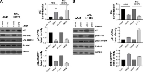 Figure 2 Silencing of SKP2 resulted in increase while overexpression of SKP2 led to decrease of p27.