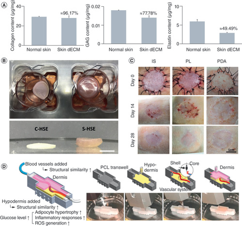 Figure 2. Design and bioprinting of dECM bioinks for skin tissue engineering.(A) Quantification of the major ECM components (collagen, GAG, and elastin) after the decellularization process. (B) Representative images of 3D cell-printed in vitro skin equivalents using type I collagen (C-HSE) and skin-derived bioink (S-HSE). Scale bar: 2 mm. (C) Morphological changes occurring in the diverse types of skin grafts during 28 days after the surgery. (D) Bioprinted skin model recreating diabetic hallmarks by the inclusion of perfusable and vascularized hypodermal compartment and augmented diabetic features.C-HSE: Human skin equivalent using collagen bioink; dECM: Decellularized extracellular matrix; ECM: Extracellular matrix; GAG: Glycosaminoglycans; IS: Inguinal split-thickness skin grafts; PCL: Polycaprolactone; PDA: 3D-printed dermal analogues; PL: Pelnac Dermal Substitute; ROS: Reactive oxygen species; S-HSE: Human skin equivalent using skin-derived extracellular matrix bioink.Modified with permission from [Citation10,Citation125,Citation126,Citation145].