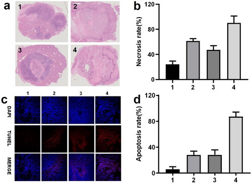 Figure 4. (a, b) Photomicrographs and statistics of the tumor sections staining by H&E (×0.6) treated by saline (group 1), 1 mg ATO (group 2); 2 mg sevelamer (group 3); 2 mg sevelamer arsenite nanoparticle (group 4). (c, d) Representative fluorescent images from TUNNEL staining are indicative of apoptosis (×400, scale bar = 50 μm).