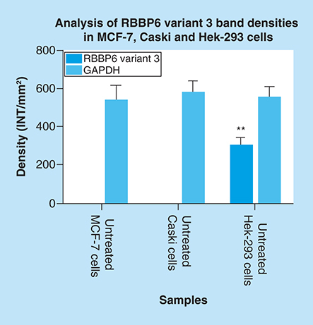 Figure 13. Graphical analysis of RBBP6 variant 3 band densities in untreated MCF-7, Caski and Hek-293 cells.Both untreated MCF-7 and Caski cells had undetectable expression of RBBP6 variant 3, only untreated Hek-293 cells show detectable levels of RBBP6 variant 3. Results were obtained from three independent experiments and were presented as ± standard error of the mean and the differences were considered significant when **p ≤ 0.001 The density was measured using Quanty‐One software.