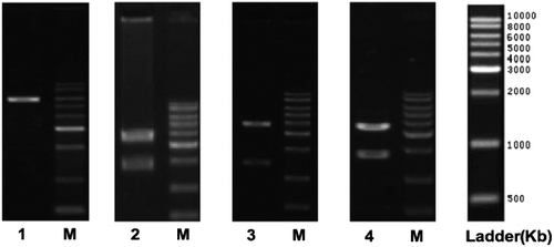 Figure 2. COX-2 gene fragment and XhoI restriction enzyme digestion. M, DNA molecular size marker; Lane 1, pYr-1.1-hU6-EGFP; Lane 2, pYr-1.1-hU6-EGFP-COX2-1; Lane 3, pYr-1.1-hU6-EGFP-COX2-2; Lane 4, pYr-1.1-hU6- EGFP-COX2-3.