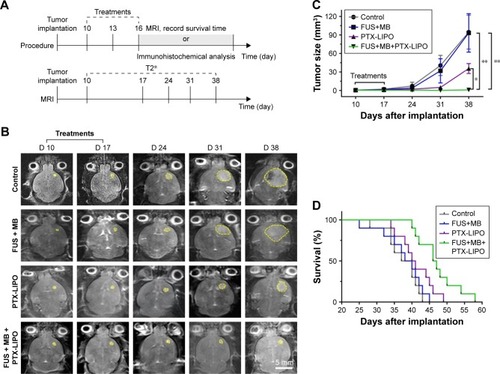 Figure 8 In vivo antiglioma efficacy in nude mice bearing intracranial glioblastoma in different treatment groups: no treatment as the Control, FUS exposure with MBs but without PTX-LIPO as FUS+MB, PTX-LIPO injection only and PTX-LIPO delivery using FUS with MBs as FUS+MB+PTX-LIPO.Notes: (A) Experimental timeline of the treatment procedure and MRI longitudinal study. Treatments were started from the 10th day after the glioma cell implantation every other 2 days for a total of three times. (B) Representative T2-weighted MRI horizontal images of intracranial U87 MG glioblastoma progression (yellow outline) before and after different treatments. Bar: 5 mm. (C) Tumor volumes from day 10 to day 38 after implantation of nude mice with different treatments (n=10, mean ± SD). *P<0.05 and **P<0.01. (D) The Kaplan–Meier survival curves of nude mice in each treatment group.Abbreviations: FUS, focused ultrasound; MBs, microbubbles; MRI, magnetic resonance imaging; PTX-LIPO, paclitaxel liposomes.